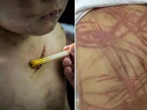 Người phụ nữ bạo hành chồng tật nguyền đến mức toàn thân đầy máu chỉ vì tranh chấp số tiền nhỏ tổ chức sinh nhật cho mẹ ruột-4