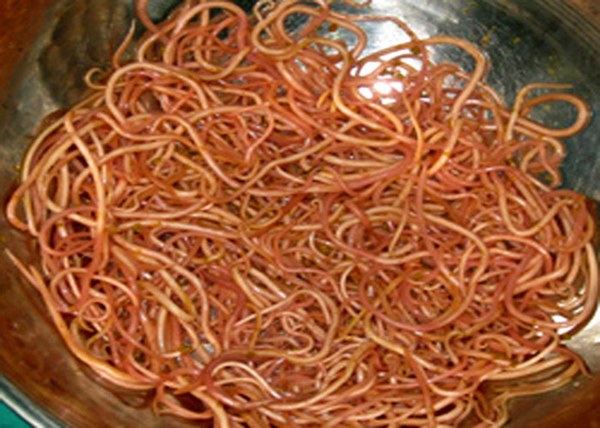 2019 - Năm của những ca bệnh kinh hoàng khi giun sán sinh sôi trong cơ thể, chọc thủng mắt, len vào tim, gan, trườn lên cả não... do thói quen ăn đồ tái sống-2