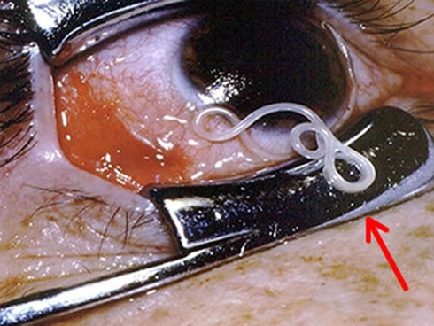 10 thói quen hại sức khỏe nhanh hơn mắc ung thư nhiều người vẫn tưởng lành mạnh-5