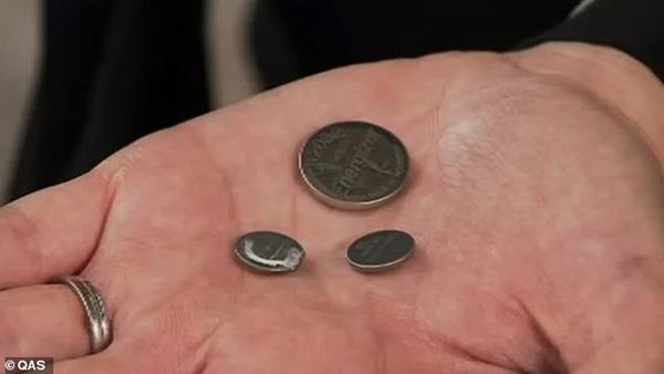 Bé gái 2 tuổi bị bỏng dạ dày bởi kẻ giết người thầm lặng có sẵn trong nhiều gia đình-2