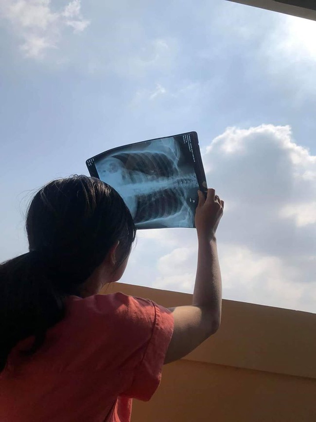 Không có thiết bị xịn sò để quan sát nhật thực, sinh viên trường Y ló cái khôn dùng vật dụng không ai ngờ-1