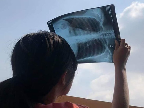 Khổ như sinh viên ngành Y thi vấn đáp: Trả lời gần 30 phút, thi xong ngủ được một giấc vẫn thấy bạn mình đang đợi thi-7