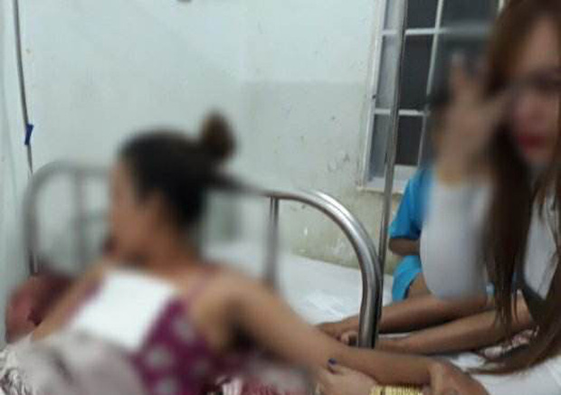 Thấy vợ ăn ốc không để phần, chồng hắt nước sôi vào mặt khiến vợ bỏng nặng-1