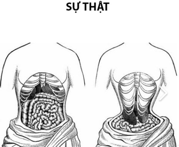 Đua nhau dùng đai nịt bụng để biến hóa” eo thon: Đẹp, thon chưa thấy nhưng tác hại thì khôn lường-4