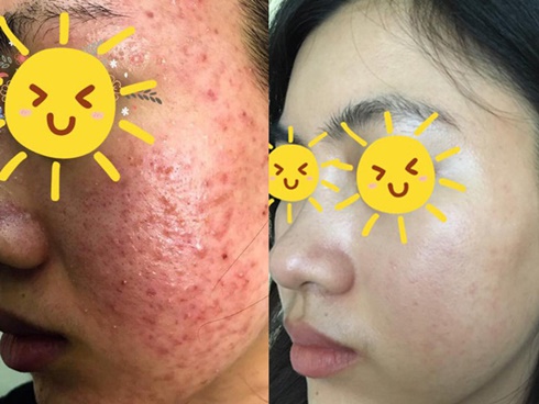 Trên máy bay suốt 64 tiếng, nàng BTV tìm ra 8 sản phẩm giúp mặt cô rạng rỡ không một chút mệt mỏi-10