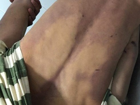 9X tử vong trong nhà giam ở Đồng Nai do phạm nhân đánh