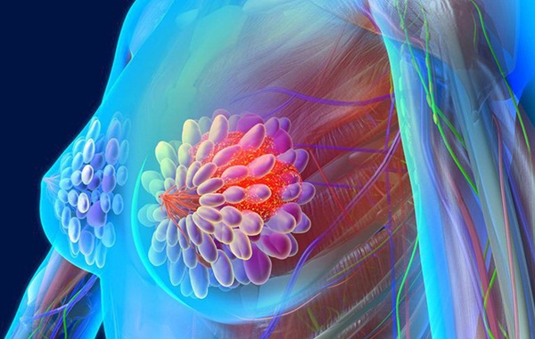 Nhầm tưởng mà không ít người mắc phải về các căn bệnh ung thư-3