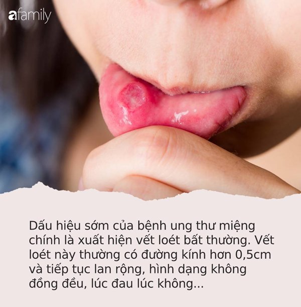 Những dấu hiệu ung thư nhưng dễ bị nhầm là bệnh vặt: Cứ lờ đi không khác gì tiếp tay cho ung thư hủy hoại bạn-4