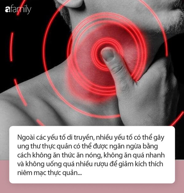 Người đàn ông bị ung thư thực quản do ăn lẩu quá nhiều: Cảnh báo loại bỏ ngay thói quen này khi ăn lẩu để tránh gây ung thư-2