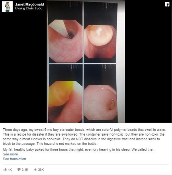 Con trai ăn gì nôn nấy, mẹ đưa đi khám thì choáng váng khi biết có thứ đồ chơi trẻ em này nằm trong ruột con-3