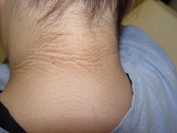 3 thay đổi lạ trên cổ ngầm cảnh báo tế bào ung thư có thể đang chực chờ trỗi dậy-1