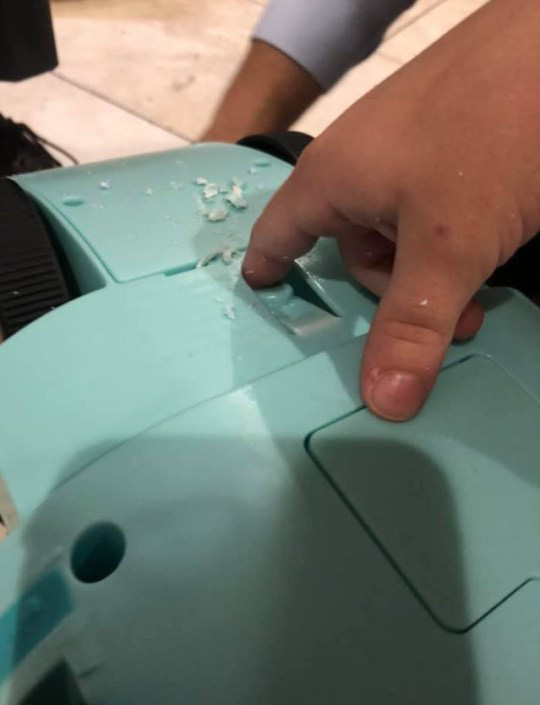 Bà mẹ lên tiếng cảnh báo sau khi phải cưa món đồ chơi trẻ em để giải cứu ngón tay cho con gái-1