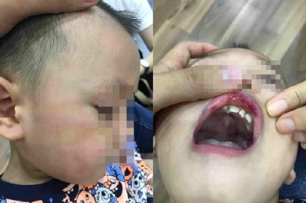 Những vụ giáo viên bạo hành học sinh gây chấn động năm 2019-4