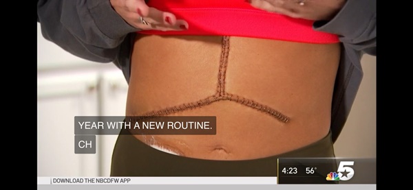 Cô gái 23 tuổi bị viêm gan cấp do dùng thực phẩm chức năng để giảm cân, làm đẹp da: BS chỉ ra lý do thực phẩm chức năng nguy hiểm hơn cả thuốc-3