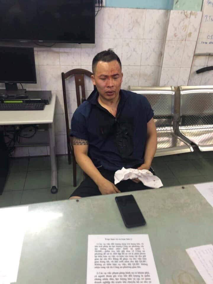 Vũ Khắc Tiệp livestream giữa tin đồn bị đánh, khẳng định cả Việt Nam này ai chẳng nợ-2