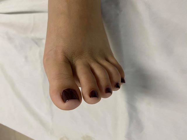 Mẹ bầu 6 tuần nghi sảy thai do sơn móng tay, bác sĩ cảnh báo chị em cẩn trọng-2