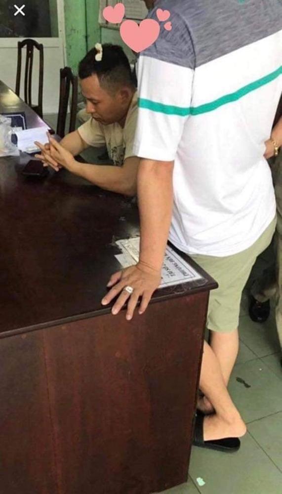 Vũ Khắc Tiệp vừa chối chuyện bị giang hồ đánh bầm dập thì tiếp tục loạt bằng chứng đanh thép lại được tung ra-6