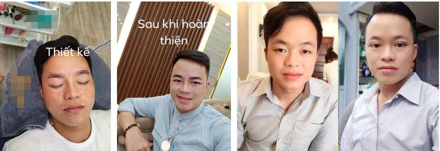 Chồng cô dâu 62 tuổi ở Cao Bằng gây sốc với diện mạo như trai Hàn Quốc sau khi phẫu thuật thẩm mỹ-3