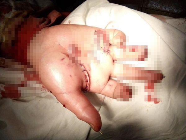 Hiểm họa kinh hoàng của pháo tự chế, chuyên gia cảnh cáo: Đừng có dại mà đùa với lửa!-4