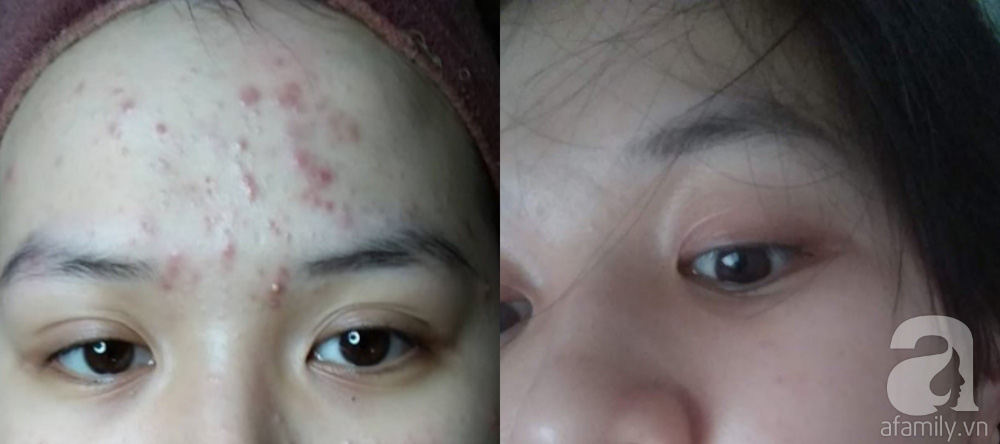 Review chai dầu dưỡng da giá rẻ, cô bạn này đã dùng và khẳng định đây là phát hiện đổi đời-1