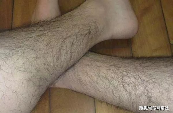Đàn ông có nhiều lông ở 3 nơi, chứng tỏ thận khỏe mạnh-3