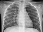 Bệnh viêm phổi lạ bùng phát tại Trung Quốc: Chuyên gia cảnh báo không được chủ quan-3