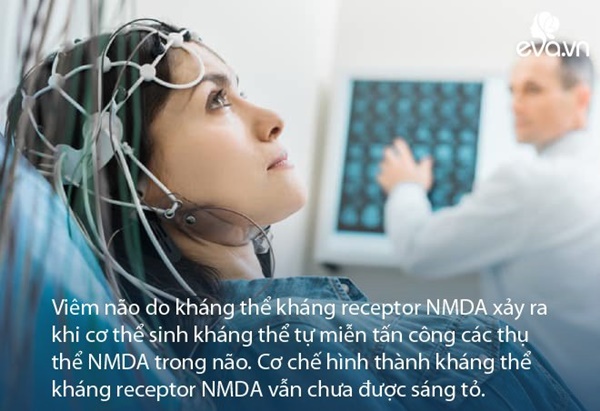 Cậu bé bị viêm não sau khi thức dậy vào ban đêm để hoàn thành 8 bài kiểm tra-2