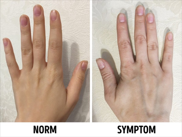 Chúng ta lão hóa nhanh hơn tại 3 thời điểm trong cuộc đời, ai vượt qua được sẽ không phải lo chuyện già hơn bạn cùng trang lứa-4