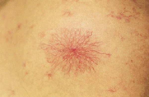 Người có chức năng gan ổn định sẽ không có 4 điểm sau trên đôi tay, cùng xem bạn có điểm nào hay không-4