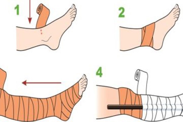 Bé 22 ngày chết vì rắn cắn, sự thật về lời đồn rắn thích mùi sữa mẹ-2