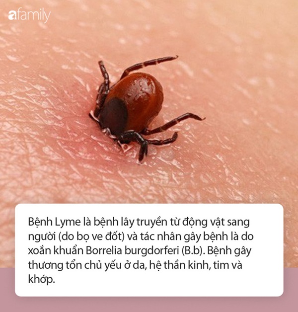 Justin Bieber thực ra đang mắc cùng lúc 2 căn bệnh đáng sợ khiến cho thân hình trở nên tàn tạ, mặt nổi đầy mụn-3