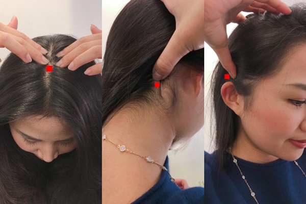 Đường ngôi tóc quá 0,8cm tức là bạn đang có nguy cơ hói, hãy ấn ngay vào 3 điểm này trên đầu để ngăn rụng tóc-2