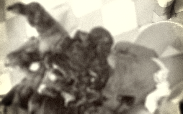 Lên mạng mua thuốc nổ tự chế làm pháo, cậu bé lớp 9 phải cắt cụt bàn tay-1