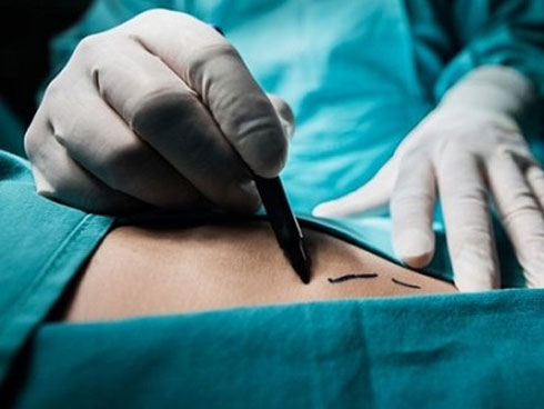 Chàng trai bán thận để mua iPhone 4 chín năm trước giờ ra sao-3