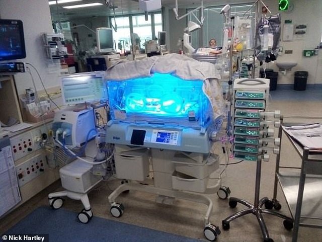 23 tuần đã bị đẻ, bé trai chỉ nặng 0,6kg, dài đúng bằng gang tay mẹ sống sót kỳ diệu-2