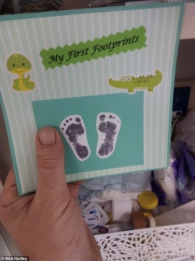 23 tuần đã bị đẻ, bé trai chỉ nặng 0,6kg, dài đúng bằng gang tay mẹ sống sót kỳ diệu-4