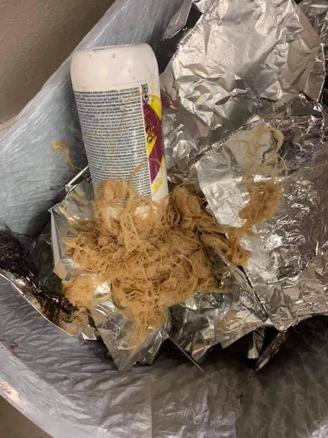 Làm tóc xinh đón Tết, cô gái hết hồn khi tẩy tóc bị rụng nguyên cả mảng đến mức hói đầu-3