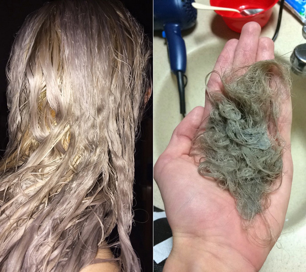 Làm tóc xinh đón Tết, cô gái hết hồn khi tẩy tóc bị rụng nguyên cả mảng đến mức hói đầu-4