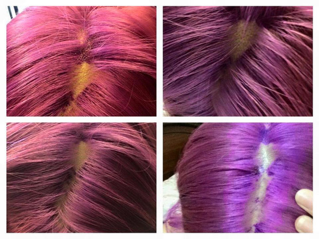 Làm tóc xinh đón Tết, cô gái hết hồn khi tẩy tóc bị rụng nguyên cả mảng đến mức hói đầu-6