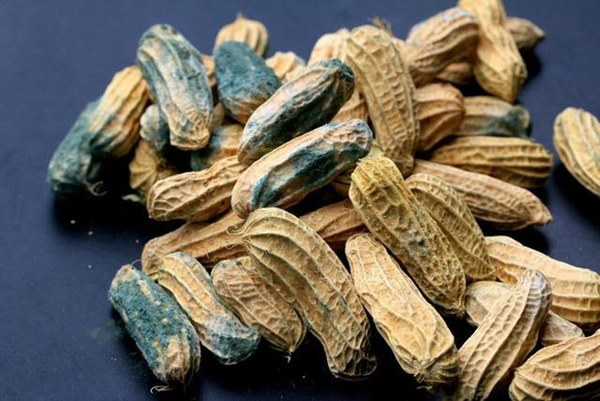 Các cơ quan cơ thể của con người sợ gì nhất: Thận sợ 3 trắng”, gan sợ 5 thứ” và dạ dày sợ 1 điều”-3