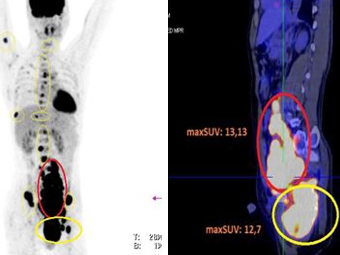 Tin uống thực phẩm chức năng, người phụ nữ Hà Nội suýt mất mạng-2