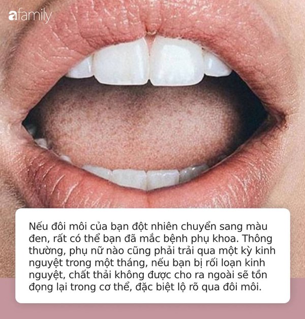Nếu vùng kín” mắc trọng bệnh thường sẽ để lộ các biểu hiện rõ mồn một trên khuôn mặt, tiếc là ai cũng bỏ qua-2