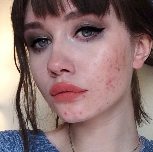 Nếu vùng kín” mắc trọng bệnh thường sẽ để lộ các biểu hiện rõ mồn một trên khuôn mặt, tiếc là ai cũng bỏ qua-3