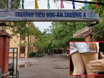 Thái Bình: Điều tra nghi vấn bé gái 3 tuổi bị xâm hại-2
