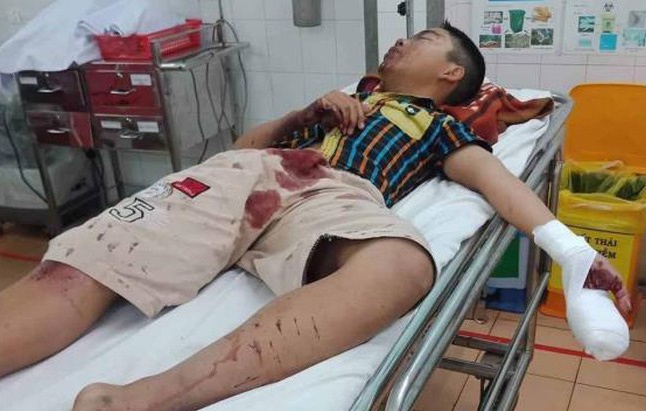 Thảm họa mang tên pháo tự chế hoành hành trước thềm Tết Nguyên Đán 2020-2