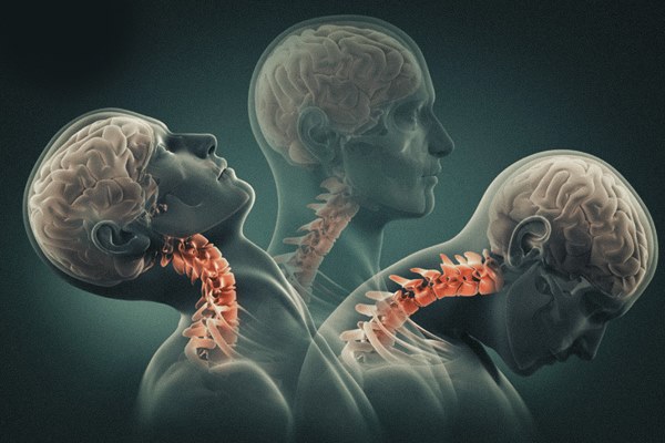 Chàng trai 27 tuổi tử vong sau khi massage cổ, 2 vị trí không nên bấm tùy tiện-3