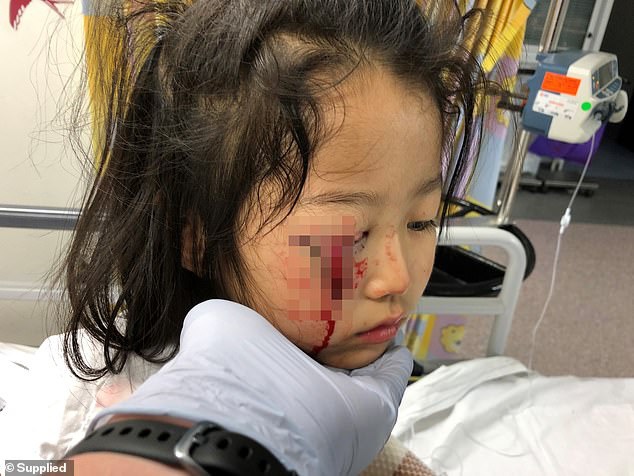 Bé gái bị mù tạm thời một bên mắt vì thứ siêu thị nào cũng có, cha mẹ đưa con đi mua sắm ngày Tết cần lưu ý-2