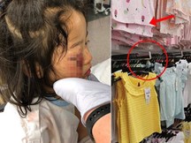 Bé gái bị mù tạm thời một bên mắt vì thứ siêu thị nào cũng có, cha mẹ đưa con đi mua sắm ngày Tết cần lưu ý