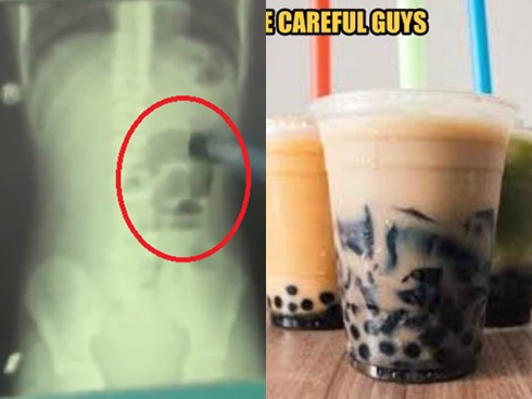 Mẹ hốt hoảng thấy con bốc cháy như cột lửa do nghịch cồn-3