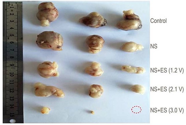 Trung Quốc phát hiện phương pháp châm cứu giúp đẩy lùi ung thư-1